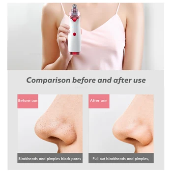Węgorz Remover Face Deep Nose Pore Cleaner Pore Trądzik Usuwanie Trądziku Próżniowe Wchłanianie Facial Beauty Clean Skin Care Machine